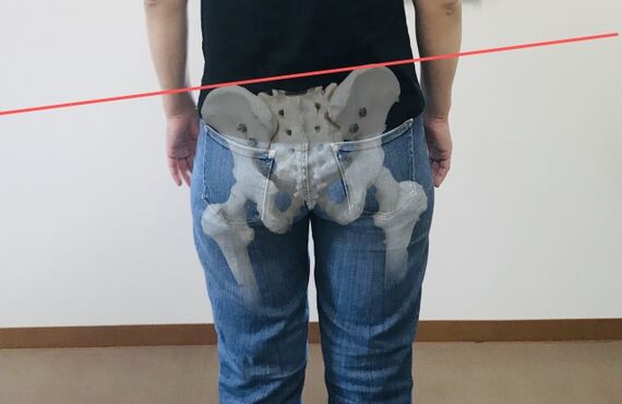 常に腰が重い、スカートがクルクル回る、足がむくむ。それ骨盤が歪んでいるかも！？一度SMiLE整骨院にご相談ください。